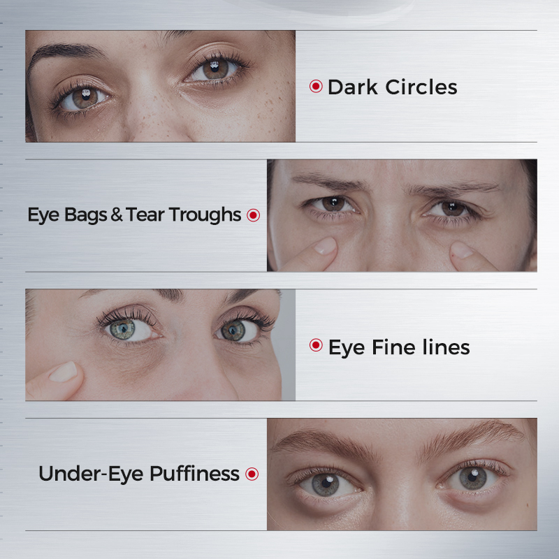 Eye Patches for Dark Circles – - Sheet Mask Collagen 评论和价格