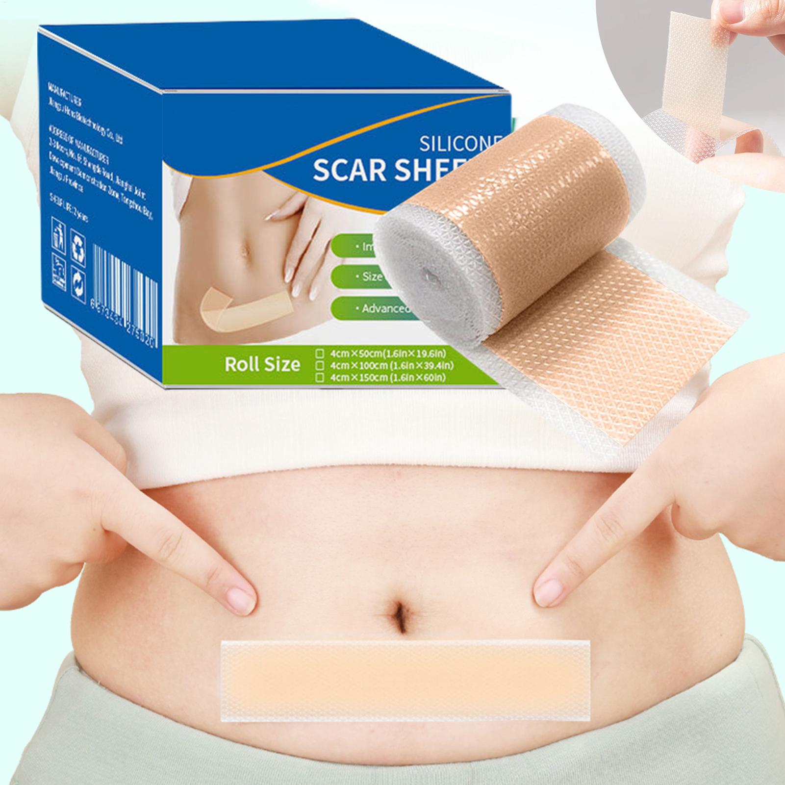 1 Roll Silicone Scar Sheets 4c - Sheet Mask Collagen 评论和价格